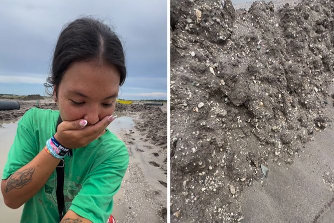 Pronasla zub Pronasla zub