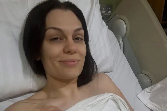 Jessie J Jessie J