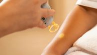Mislila sam da će uklanjanje tetovaže biti lako: Evo kako stvari stoje posle godinu dana
