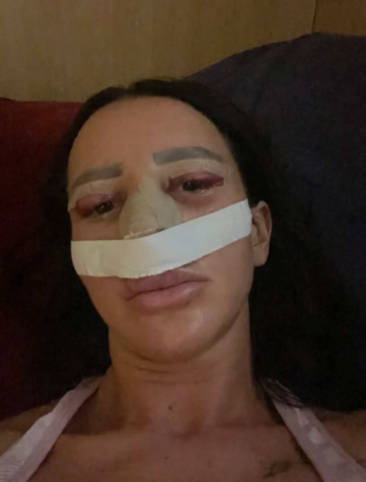 Slađa Poršelina nedavno imala operaciju: Sada se oglasila nakon napuštanja bolnice "Jedva sam preživela..."