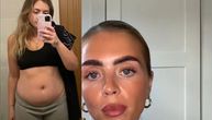 Bez dijete, bez brojanja kalorija: Mama smršala 16 kilograma i zategla telo kao nikad pre
