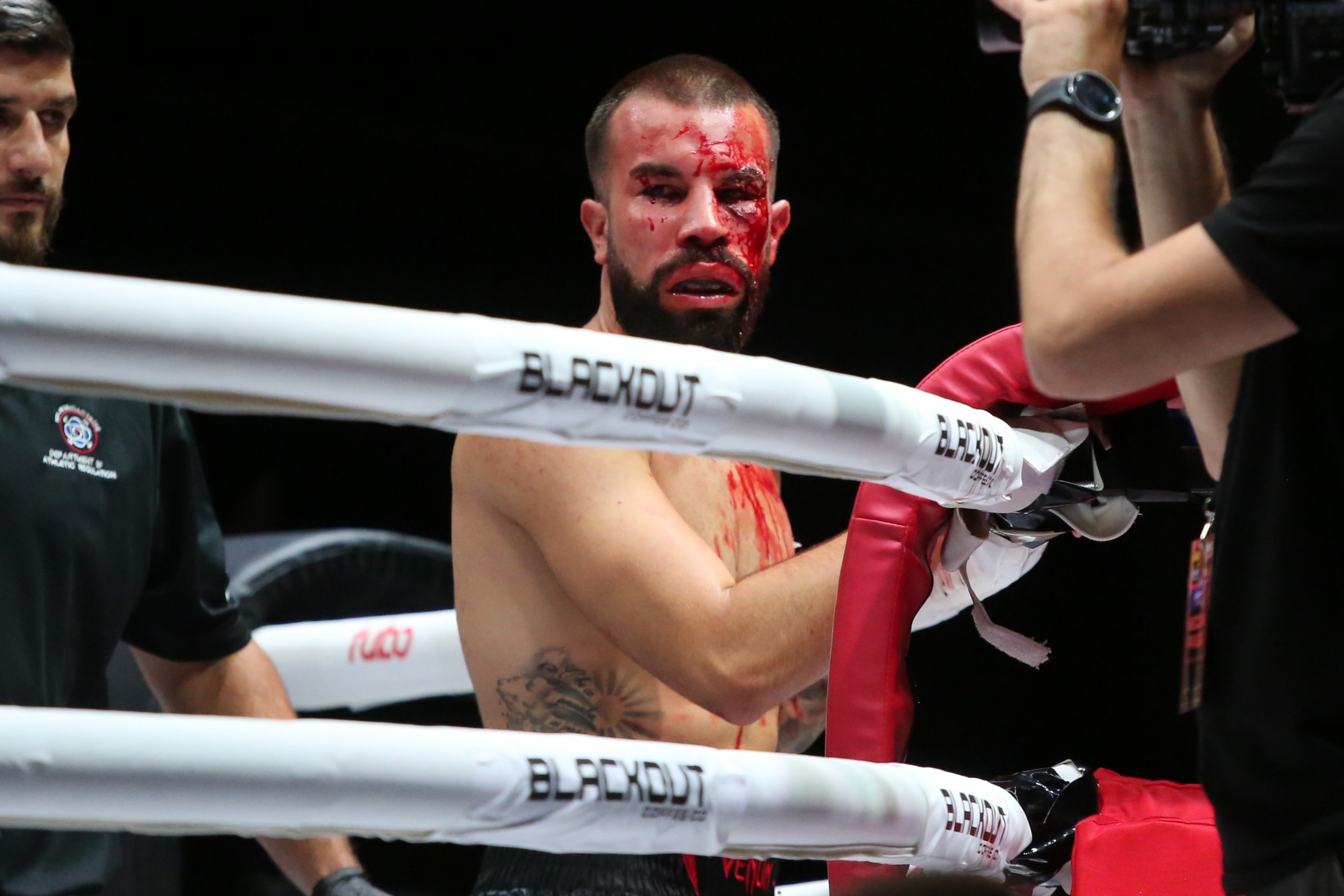 Ovako su izgledala lica Dobrijevićevog i Kocijevog rivala posle borbe golim šakama: Čeka nas krvavi rat!