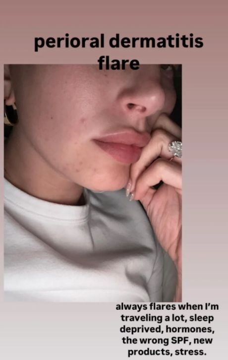 Hejli Biber Hejli Biber