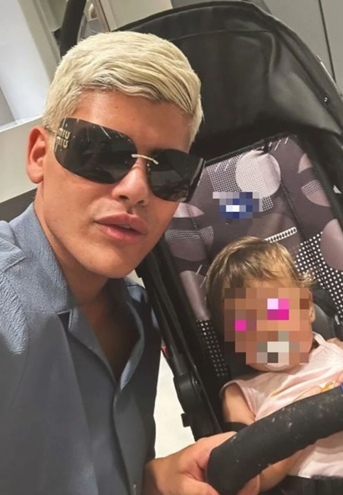 Pokazao je rezultate nakon što je spao otok: Uroš povećao usne, mnogi ga prozvali "Moraš li to da uradiš"