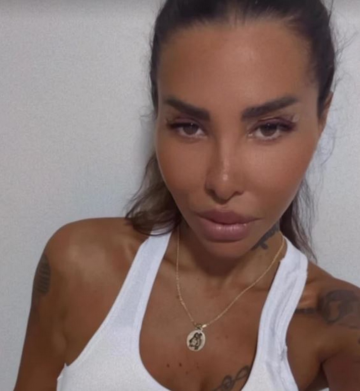Aneli objavila slike posle estetskih zahvata: Pokazala ožiljke nakon ovih intervencija, ovo je radila na sebi