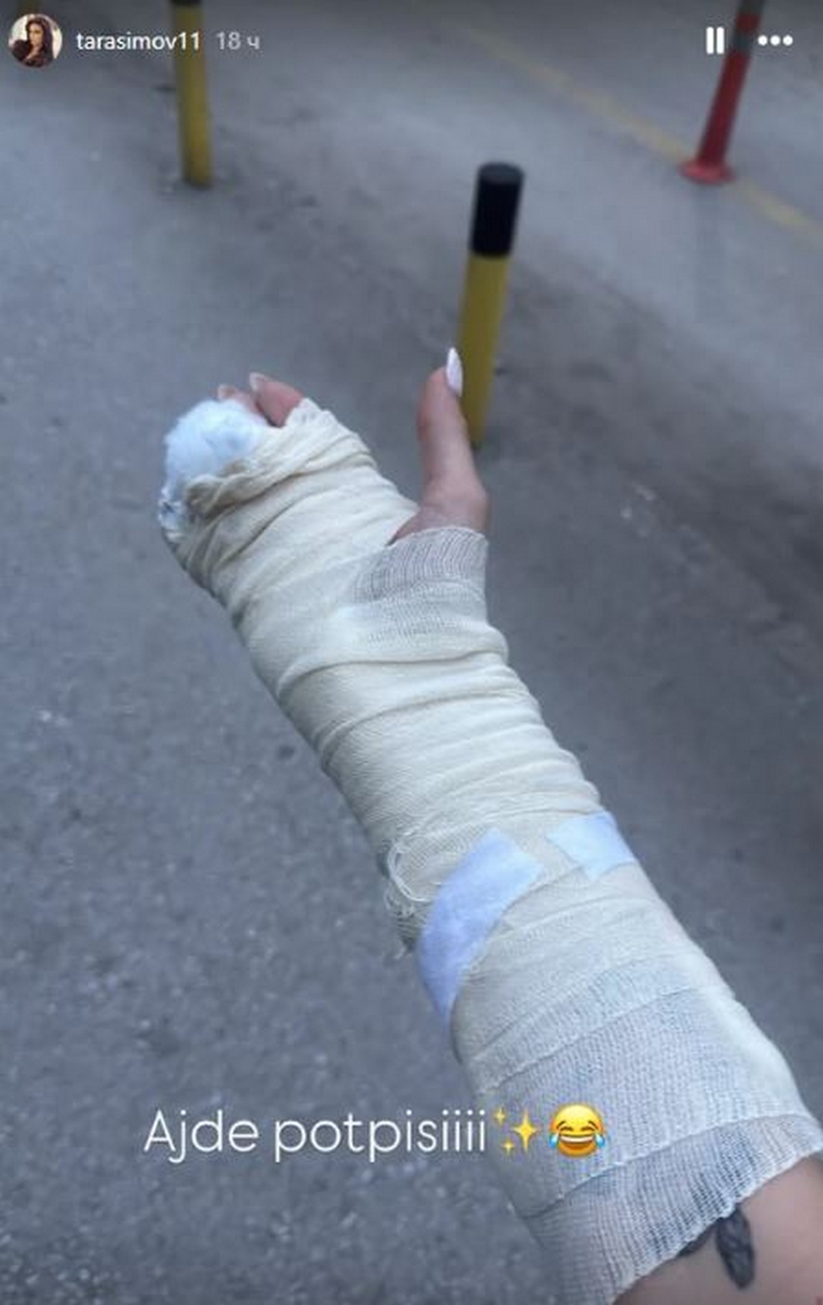 Tara Simov završila u bolnici! Pokazala ruku u zavoju posle povrede: Evo šta joj se desilo