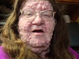 Mercedes  ima više od 200 tumora