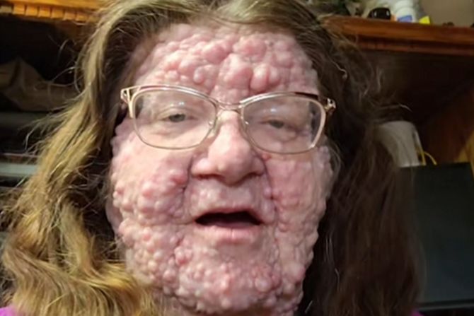 Mercedes  ima više od 200 tumora