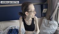 Jela 5 breskvi i malo sira svaki dan da bi smršala: Anastasija sada ima samo 29 kilograma i život joj je borba