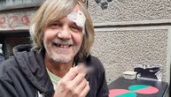 Bez prednjeg zuba i sa ranom na čelu, Žika Todorović objavio sliku i zabrinuo mnoge: "Posle nesporazuma..."