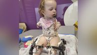 Tužna prognoza za srpsku "bebu sa krilima": Irina (2) nema kolena, ni ruke! Iz Bora stiže srceparajući vapaj