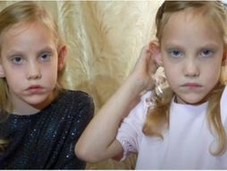 Sijamske bliznakinje Maja i Lija