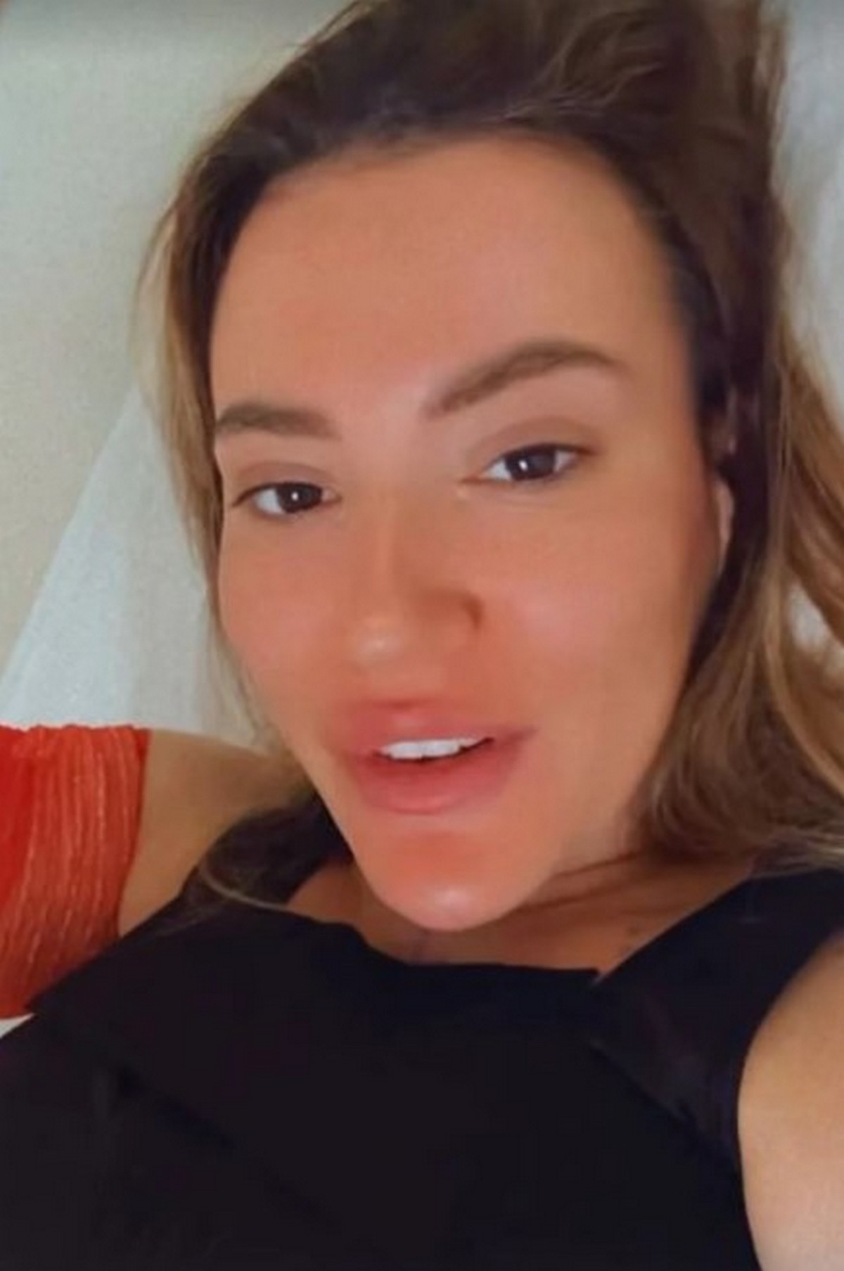 Operisana Kristina Spalević: Oglasila se iz bolnice, uradila pet estetskih operacija "Naredni dani su najteži"