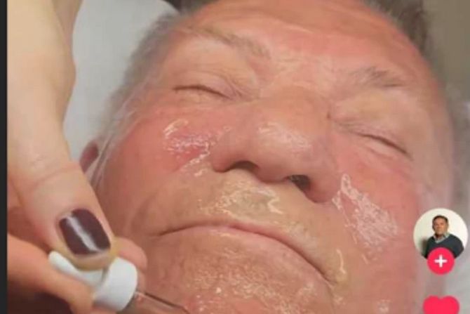 Miloš Bojanić kod kozmetičara