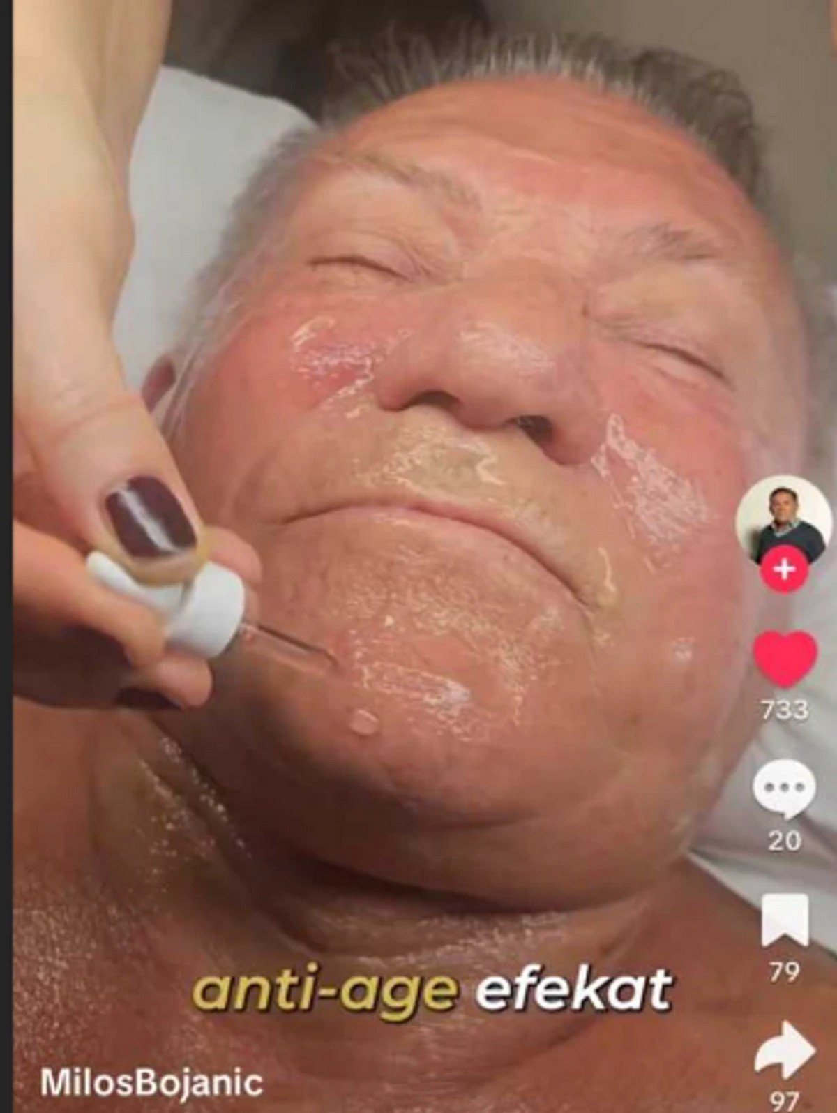 Folker (73) rešio da se podmladi: Otišao u kozmetički salon, zbog njegovih tretmana se usijale mreže