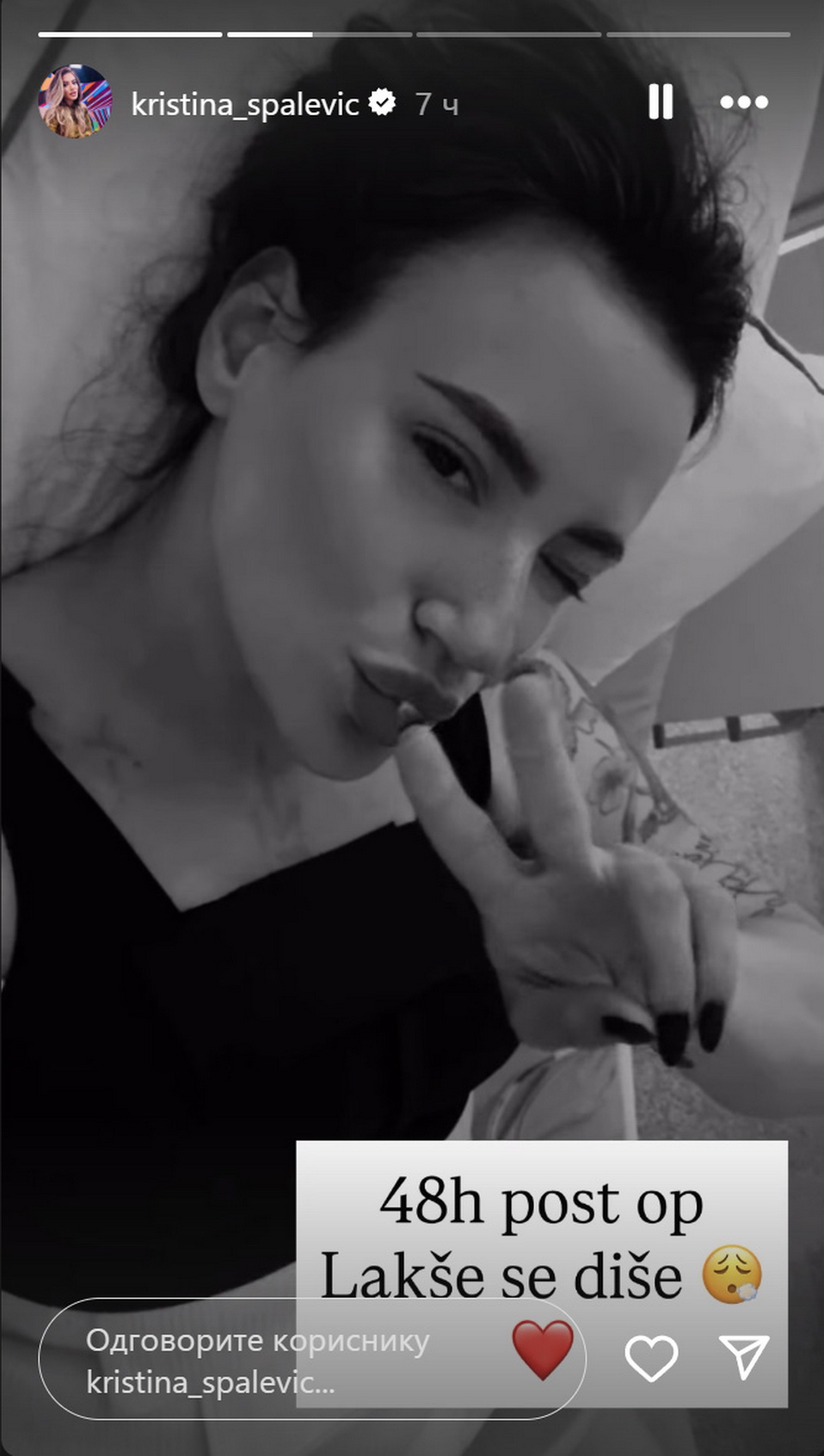 Kristina Spalević pokazala kako izgleda posle 5 operacija! Objavila sliku iz bolničkog kreveta: Lakše se diše!