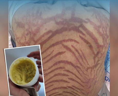 Žena u Kini , zmijska koža