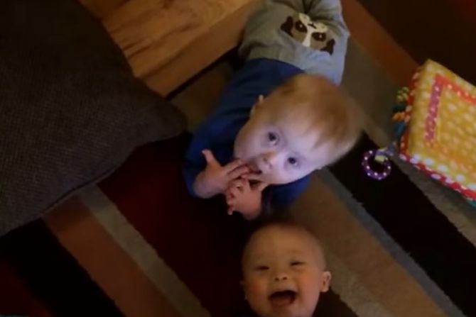 blizanci daunov sindrom