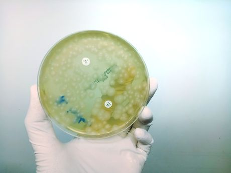 laboratorija, bakterija