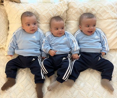 Porodica Donić, jednojajčane trojke