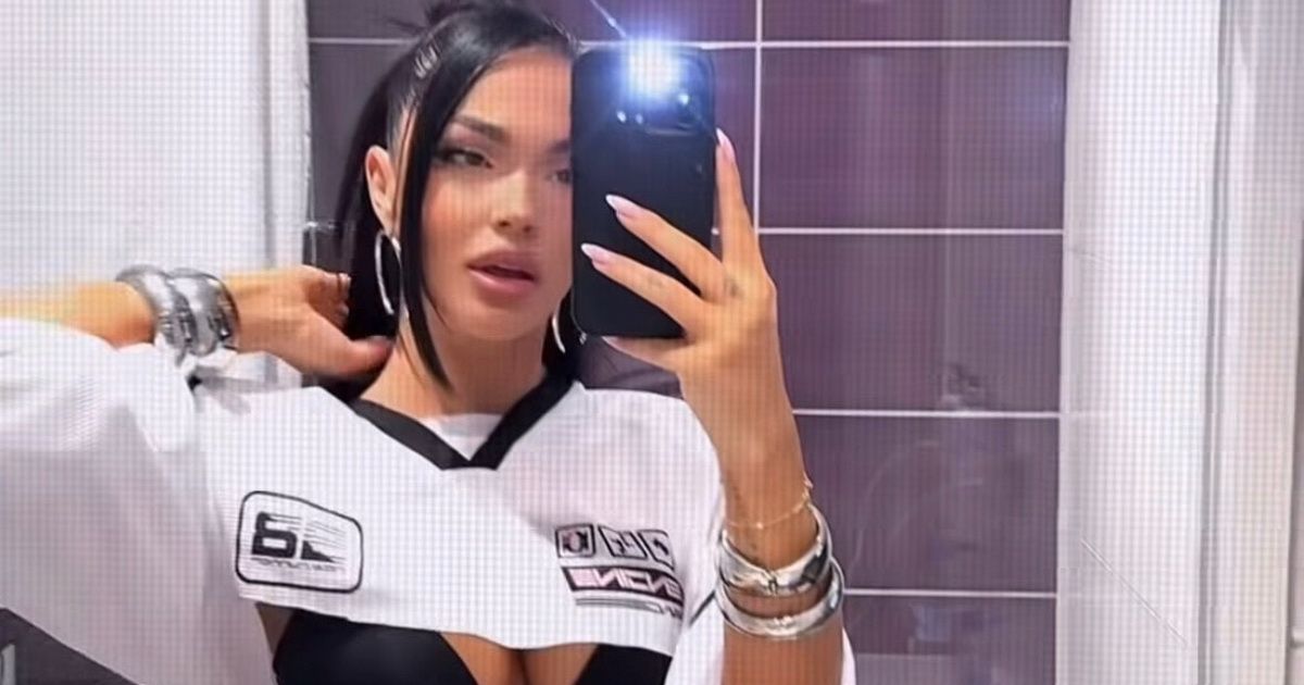 Visited a Plastic Surgeon for the First Time at 16: The Singer Revealed What She Changed About Herself "I Didn't Overdo It"