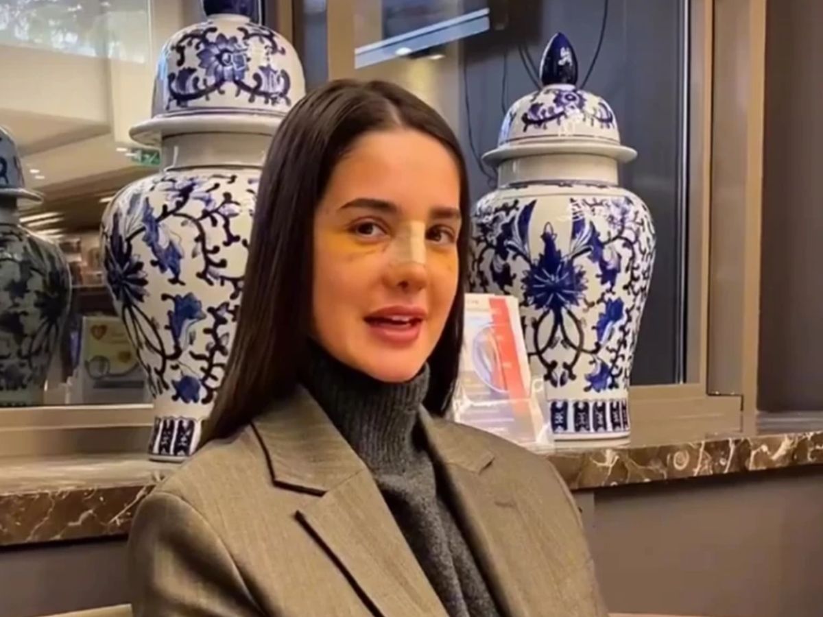 Anđela pokazala prve slike nakon operacije nosa: Oglasila se iz Turske posle intervencije "Suzila sam..."