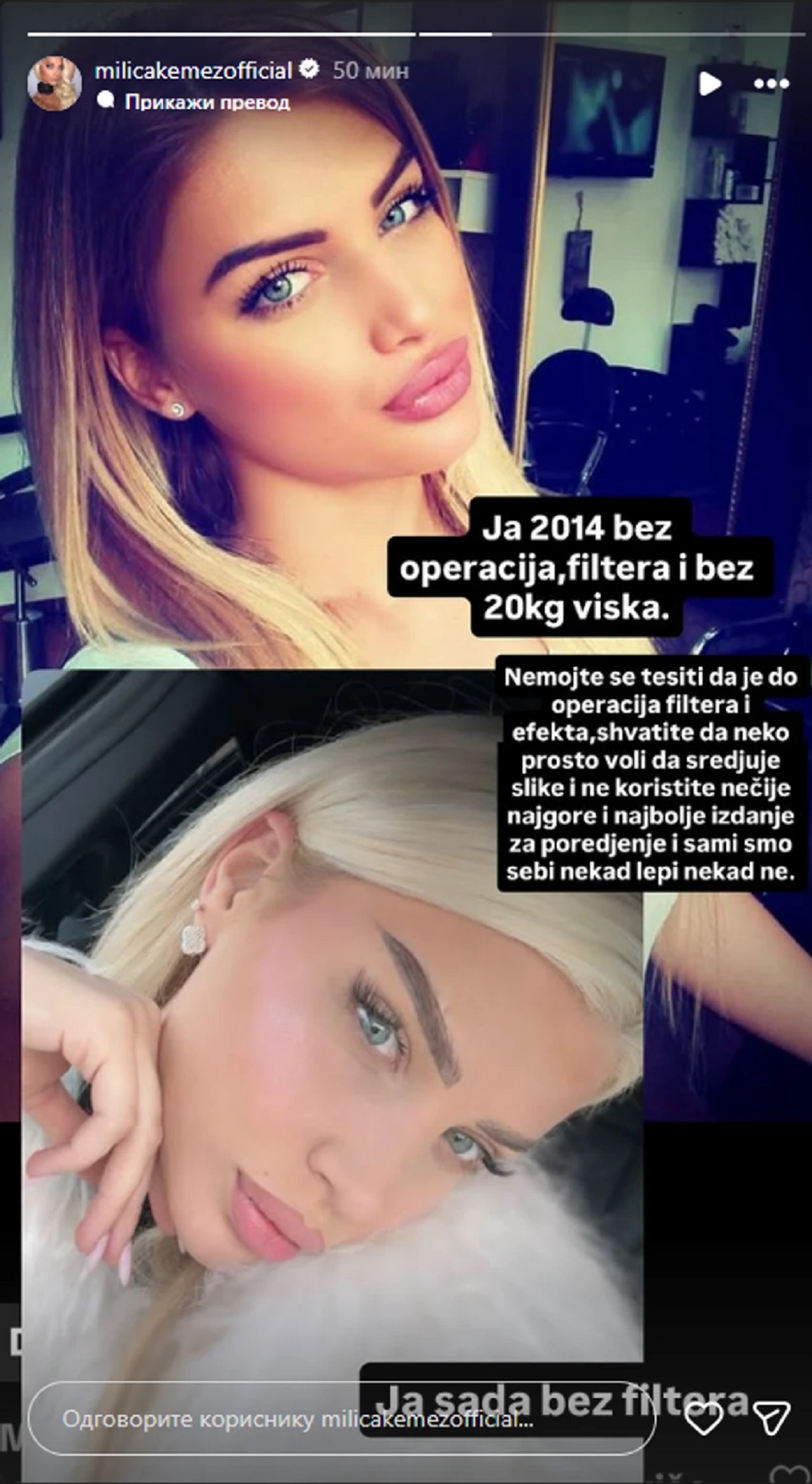 "Bez operacija i 20 kg viška!" Milica Kemez pokazala kako je izgledala pre 11 godina: "Nemojte se tešiti"