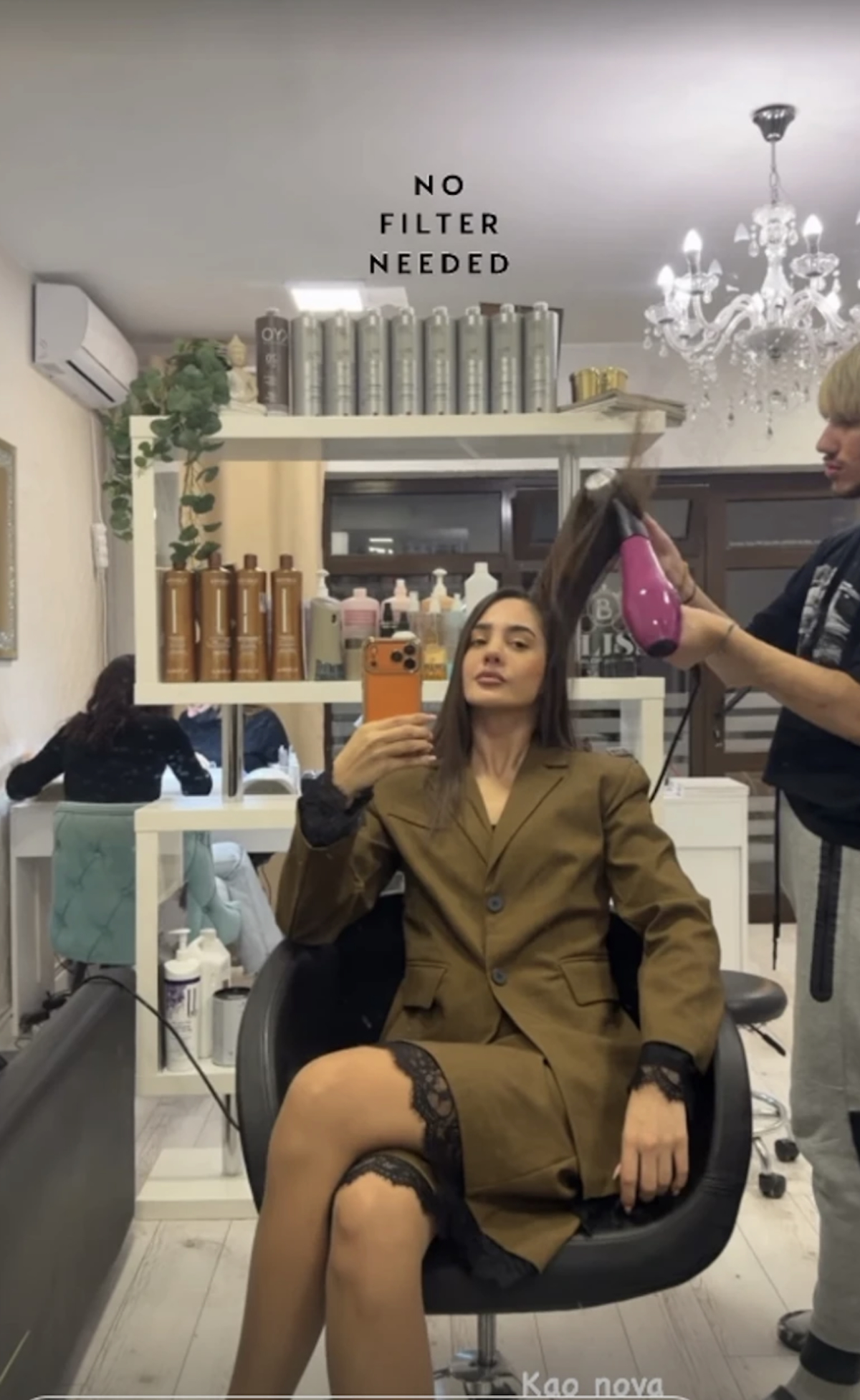 Anđela Đuričić pokazala novi nos: Skinula zavoje nakon operacije, ljudi u čudu zbog njenog novog izgleda