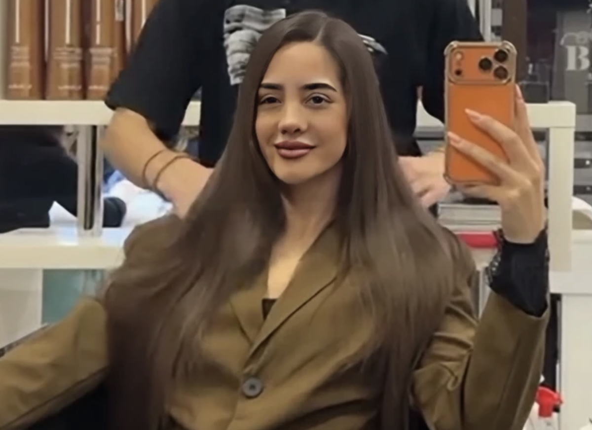 Anđela Đuričić pokazala novi nos: Skinula zavoje nakon operacije, ljudi u čudu zbog njenog novog izgleda