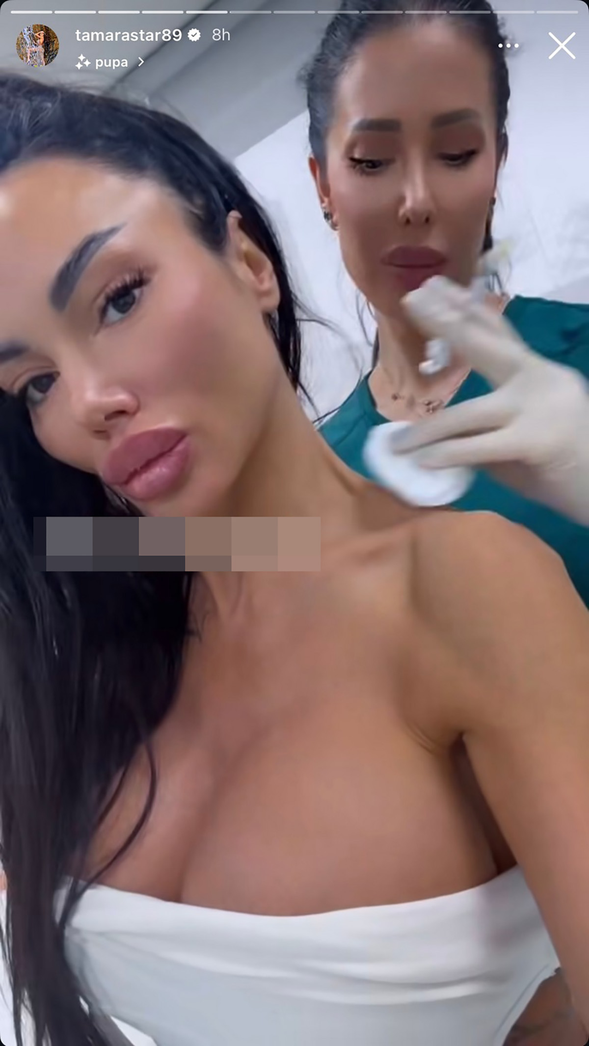 Imala preko 100 estetskih zahvata, a sada uradila i ovo: "Ko nema vrat, neka ga napravi"