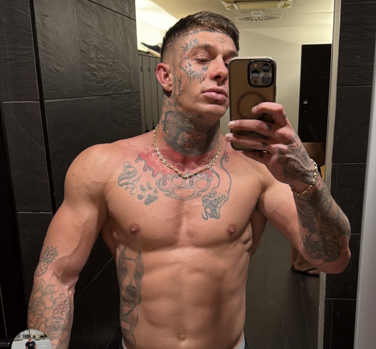 Fran pokazao kakva je "zver" postao nakon lečenja u bolnici "Laza Lazarević": Napucan, sad ljubi ovu lepoticu