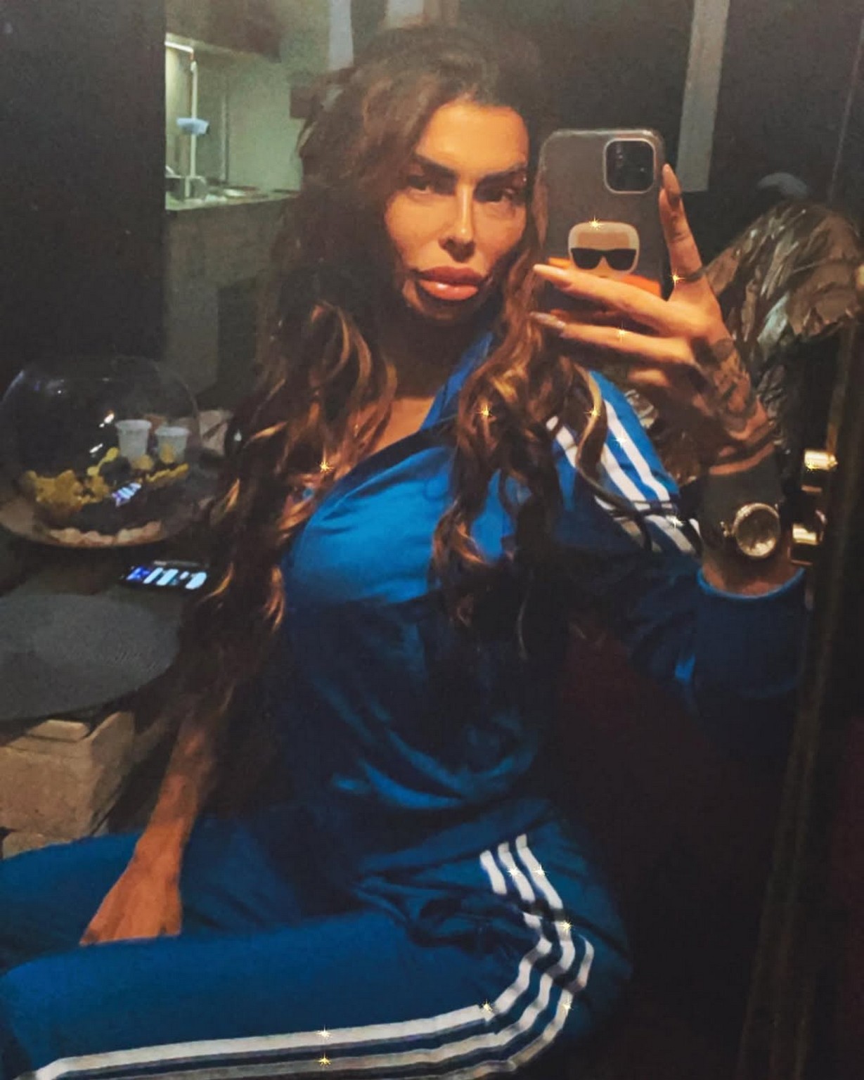 Bivšu zadrugarku dečko ostavio na početku trudnoće! Sve se preokrenulo preko noći: "Dobijam jake injekcije"