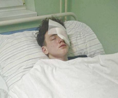 Martin, petarda, slovacka