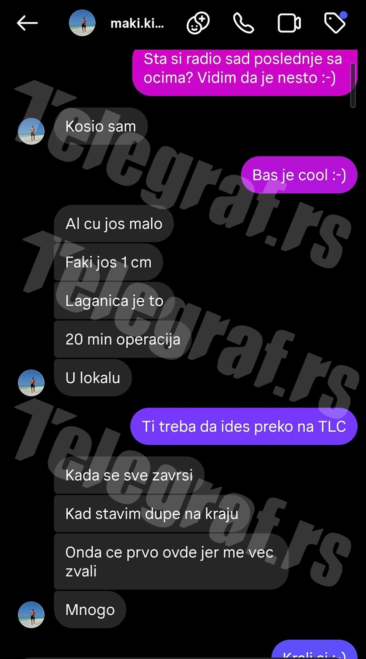 Estradni frizer pre smrti istetovirao usne ove starlete! Pogledajte sliku Matije Radulovića iz tatu studija