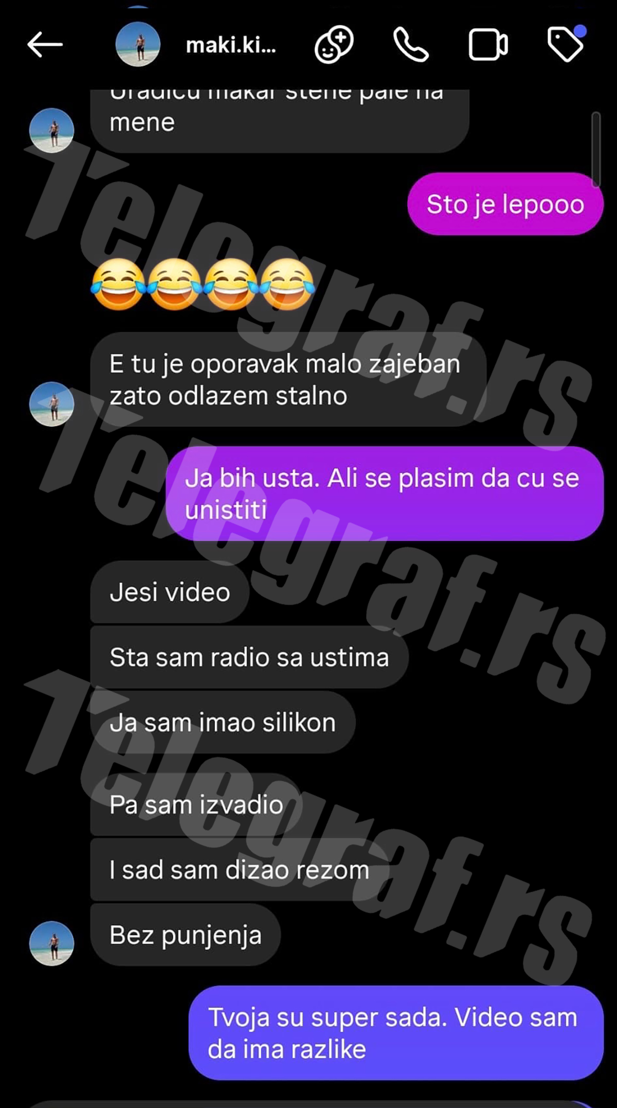 Estradni frizer pre smrti istetovirao usne ove starlete! Pogledajte sliku Matije Radulovića iz tatu studija