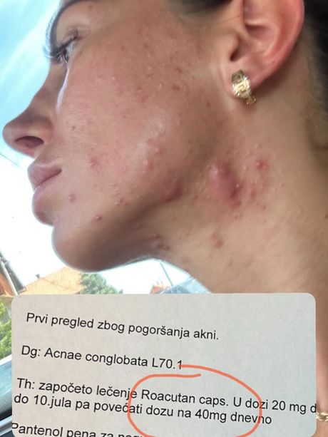 Aleksandra Tadić Cipka