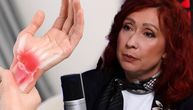 Doktorka sa VMA upozorava da REUMA ne bira godine, ovo su simptomi koji na početku deluju sasvim bezazleno