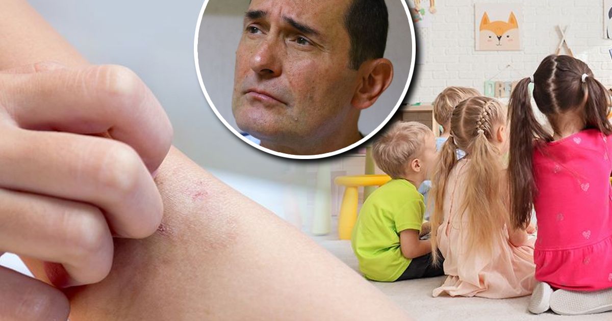 Ova greška može da bude opasna! Čuveni srpski lekar upozorio šta nikako ne raditi ako dobijete ŠUGU ILI VAŠKE