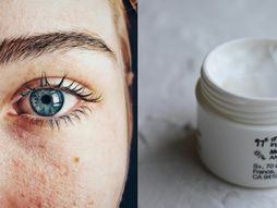 oko, krema, podočnjaci