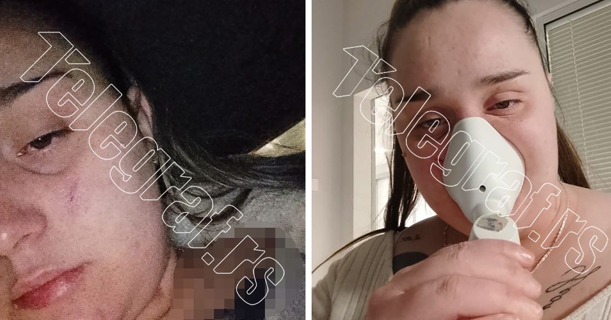 “MOLILA SAM GA DA ME NE UNAKAZI” Djevojka je preživjela pakao u Beogradu, sjekla monstruma nožem gdje god je stigao – Vijesti