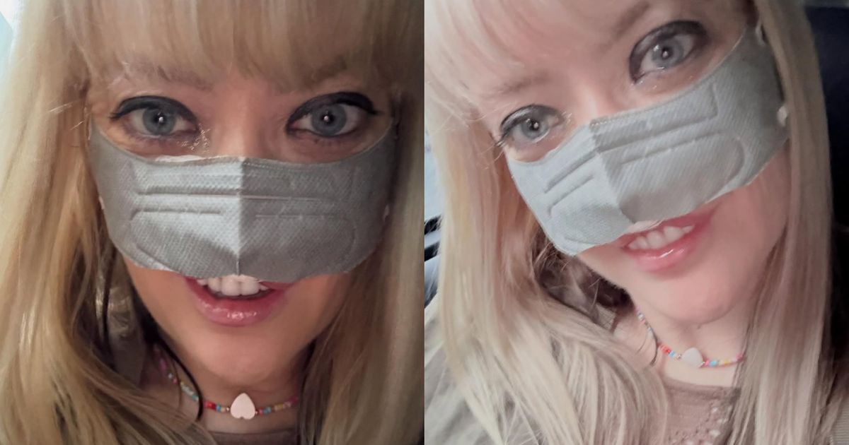 Went to Turkey for teeth, returned with TRAGIC consequences: After implant surgery, she can't breathe through her nose