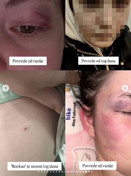 žrtva nasilja iz Surčina