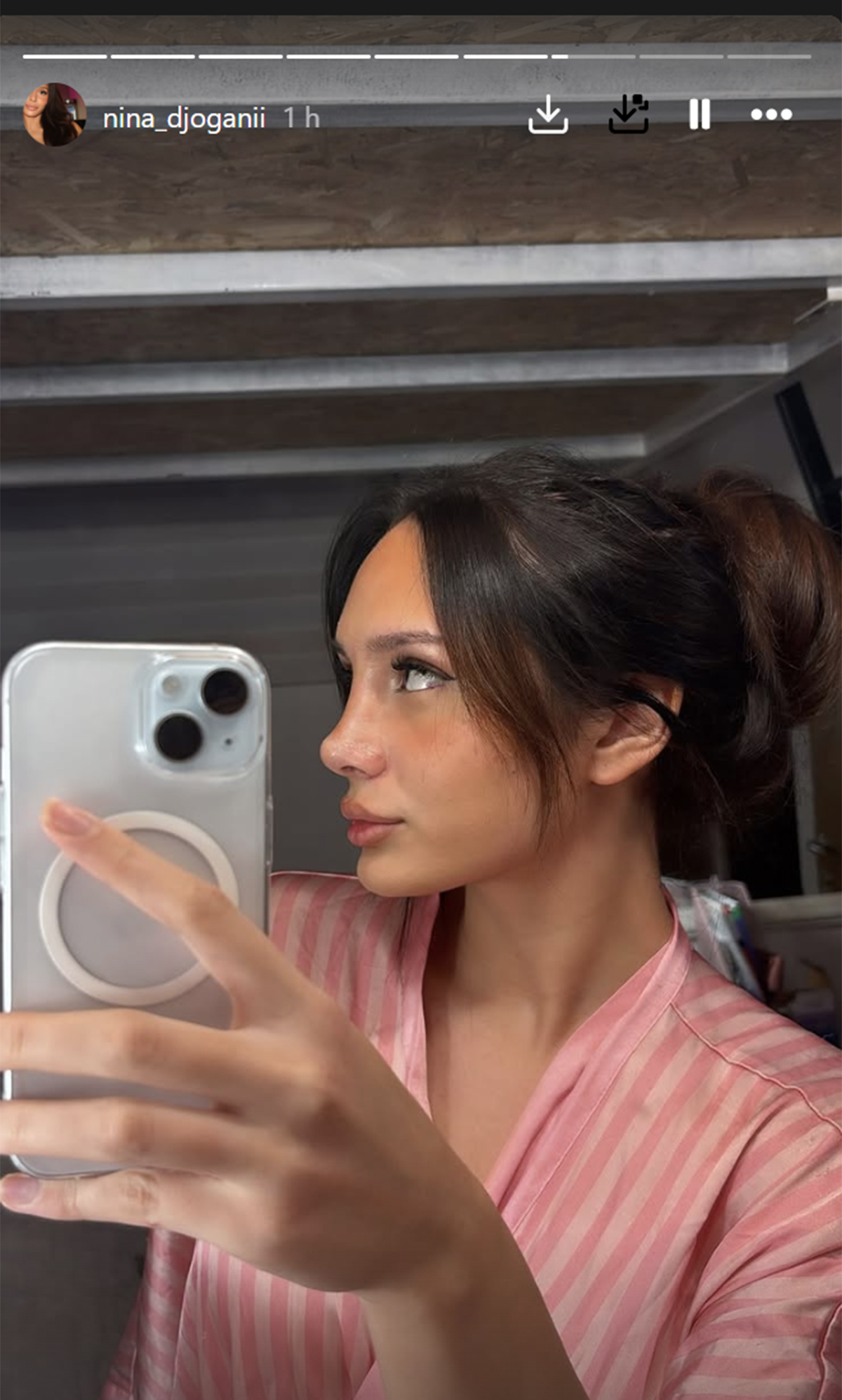 "Nisam morala da operišem nos, ali je bio veći na slikama" Nina Đogani o intervenciji: "Nisam bila ružna"