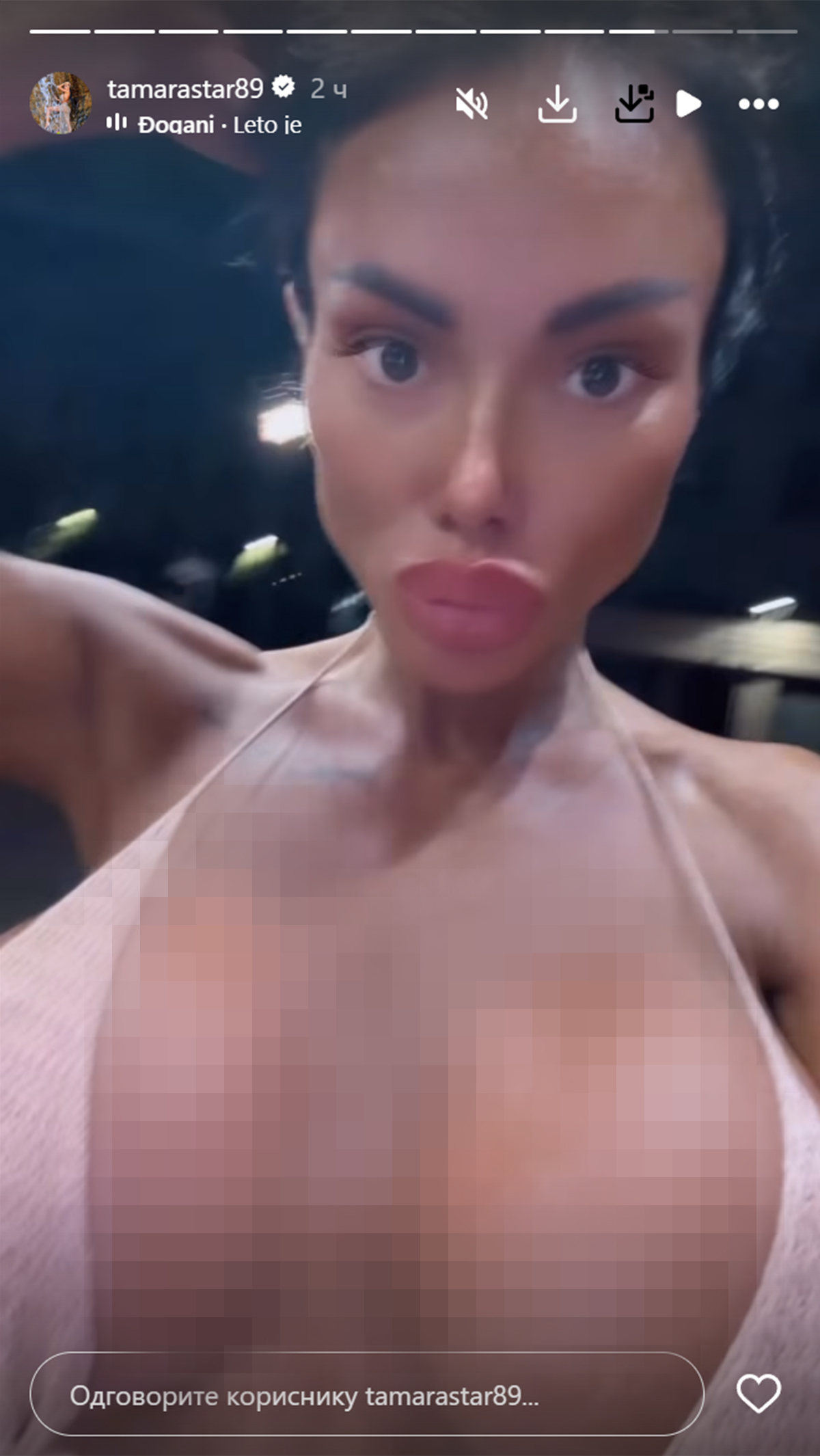 "Imala sam 100 intervencija" Starleta vadila silikone pa ih vratila: Mreže gore zbog njenih oblina - sve seva