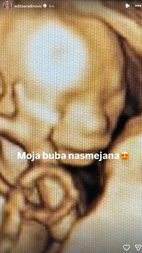 Objava Edite Aradinović