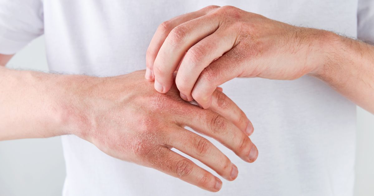 Ako su vam ruke stalno hladne, ovo obavezno proverite: Malo ko zna da to može biti zapravo alarmantan simptom