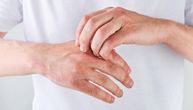 Ruke su vam stalno ispucale? Potopite ih 10 minuta u ova dva sastojka i koža će ponovo biti mekana