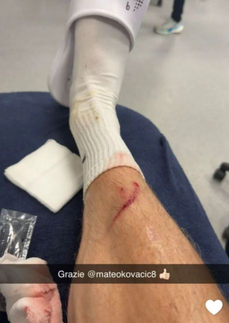 Erling Haland, povreda