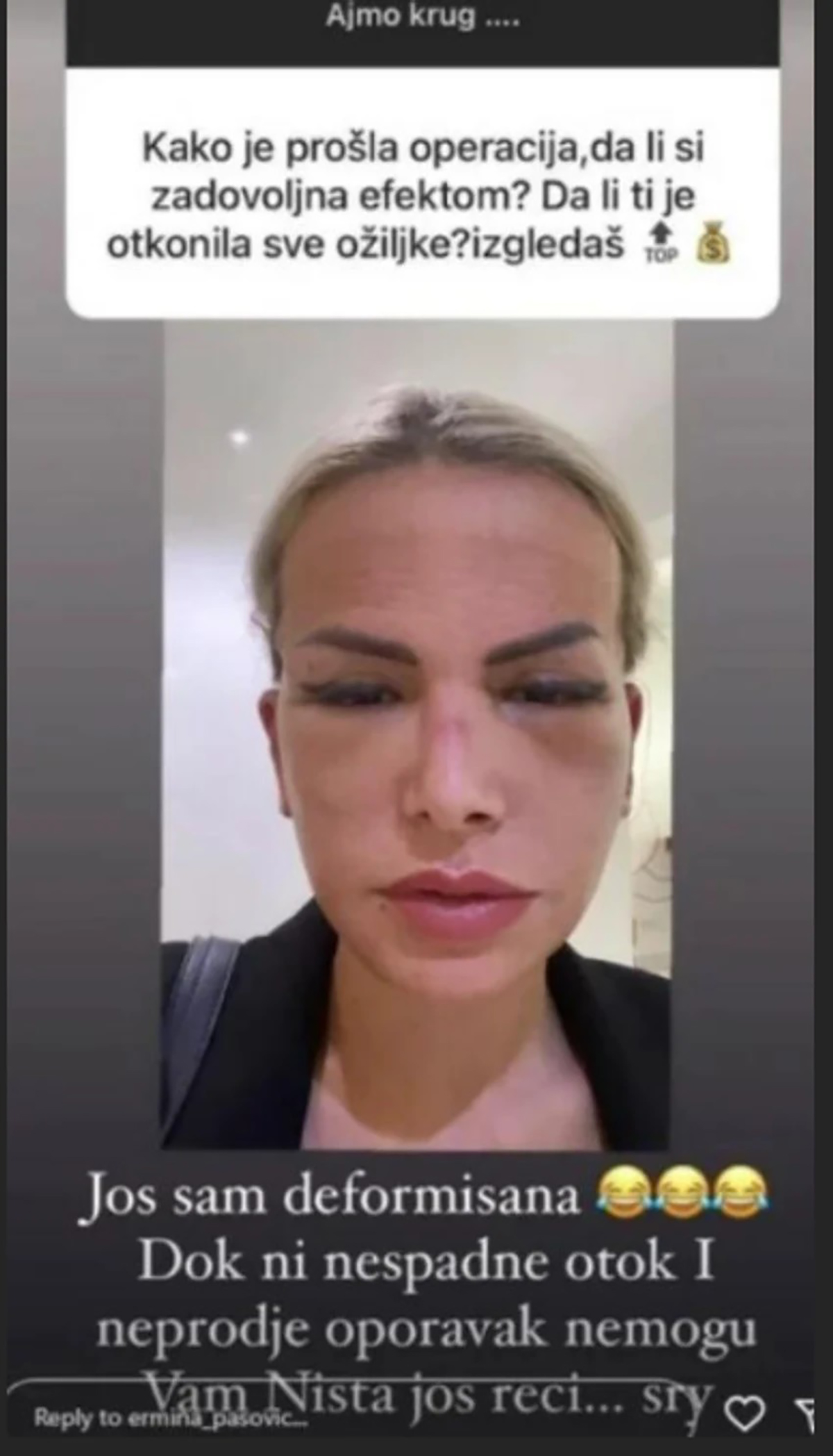Uradila potpuni "remont" i pukla na operacije 15.000 evra: Bivša zadrugarka uživa van Beograda i ima OVAJ hobi