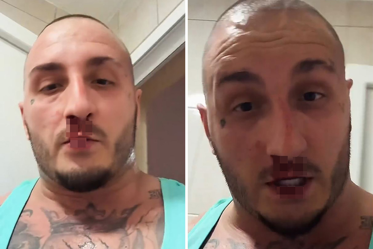 Srpski reper usred noći objavio jeziv snimak! Krv mu se sliva niz lice, spomenuo batine